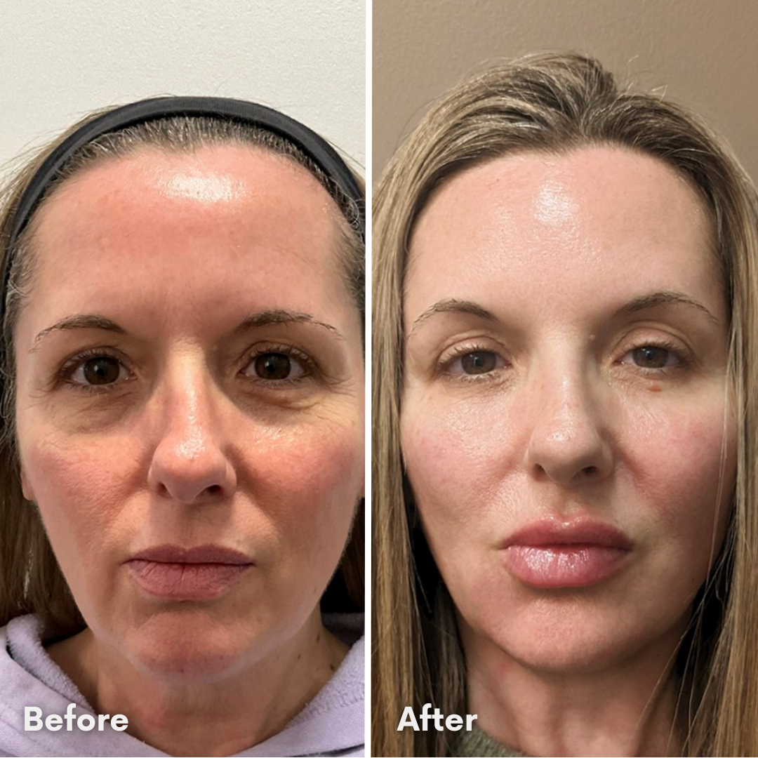 LUMINISKINN™ Bio-Collagen Real Deep Mask — Overnight Glow Treatment