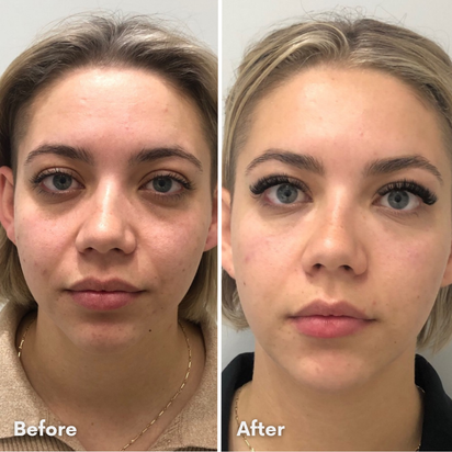 LUMINISKINN™ Bio-Collagen Real Deep Mask — Overnight Glow Treatment