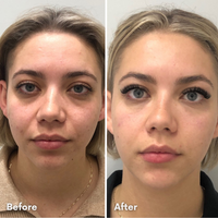 LUMINISKINN™ Bio-Collagen Real Deep Mask — Overnight Glow Treatment